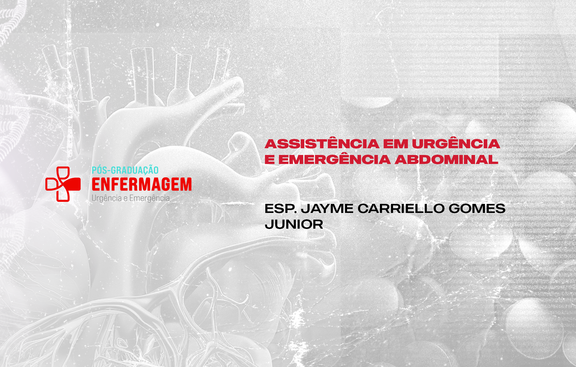 Course Image ASSISTÊNCIA EM URGÊNCIA E EMERGÊNCIA ABDOMINAL (AULA BÔNUS)