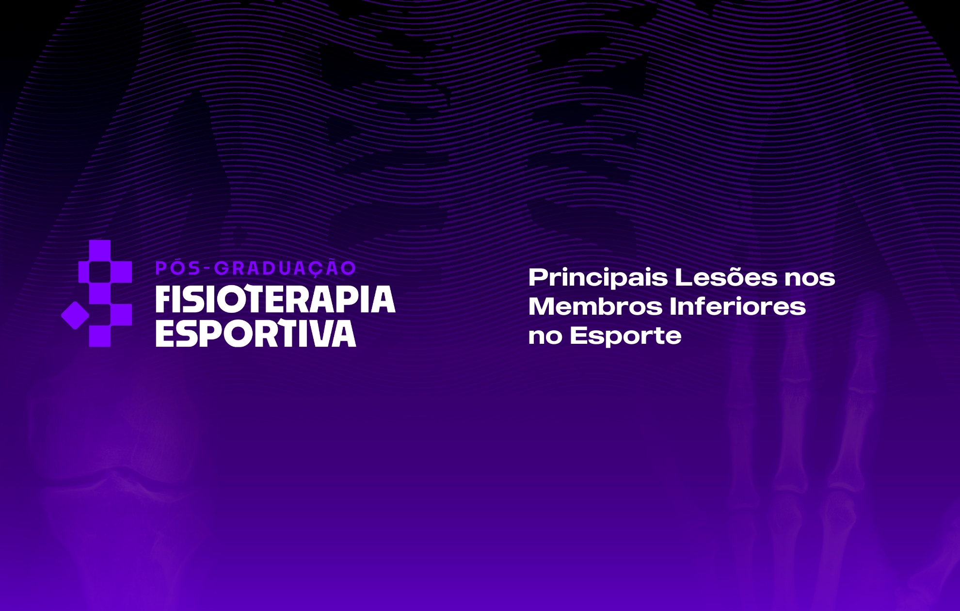 Course Image PRINCIPAIS LESÕES DOS MEMBROS INFERIORES NO ESPORTE 