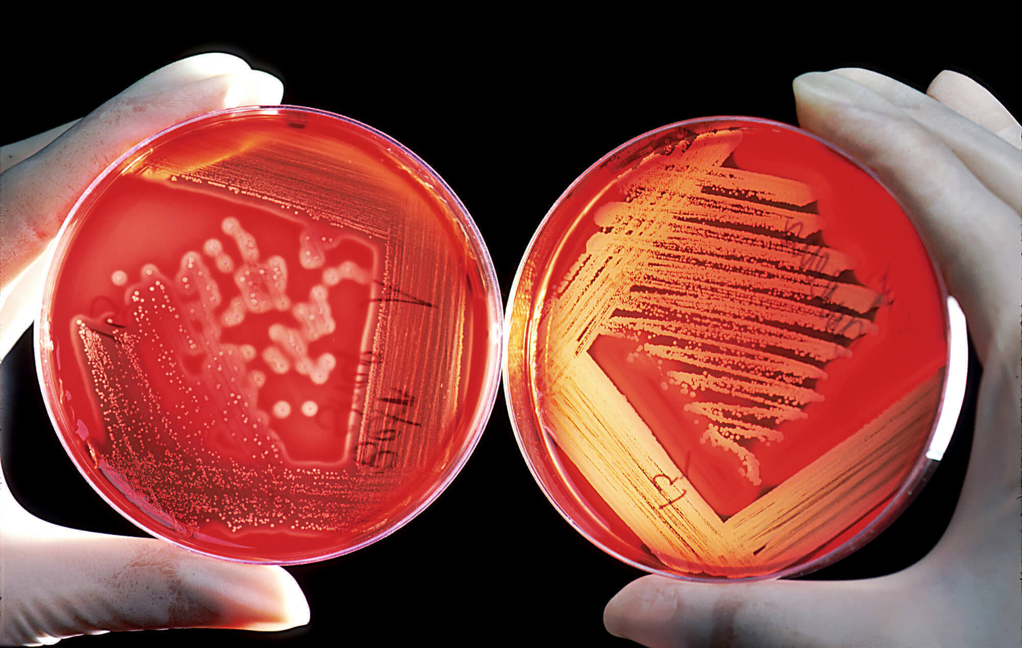 Course Image EAG04-A - MICROBIOLOGIA