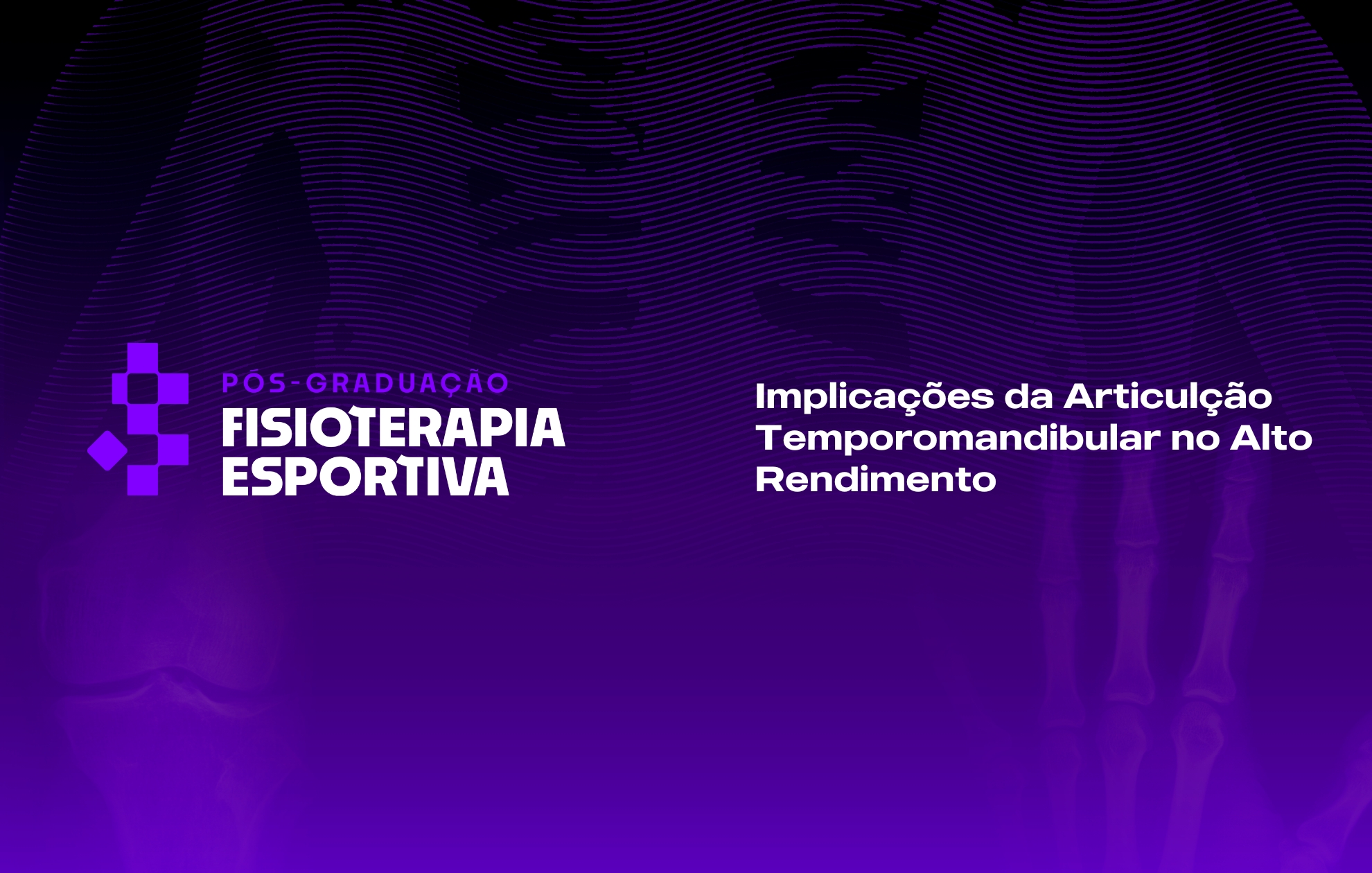Course Image IMPLICAÇÕES DA ARTICULAÇÃO TEMPOROMANDIBULAR NO ALTO RENDIMENTO